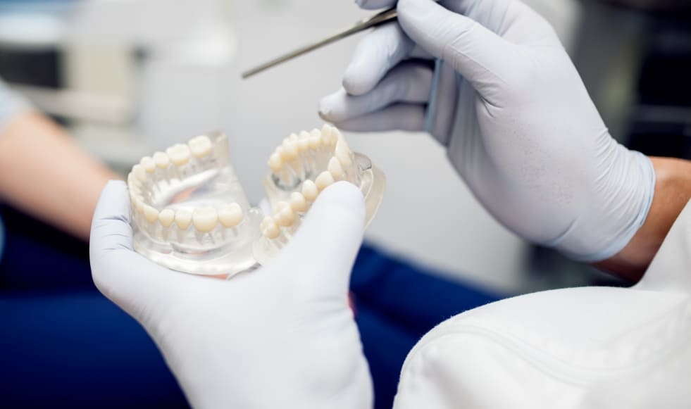 Studi Dentistici Dex | Conservativa