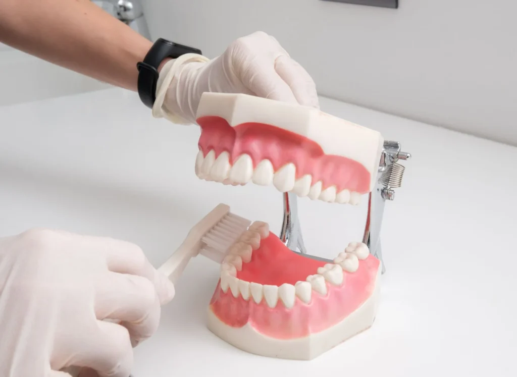 Cosa Sono le Faccette Dentali e Come Possono Trasformare il Tuo Sorriso 1 Cosa Sono le Faccette Dentali