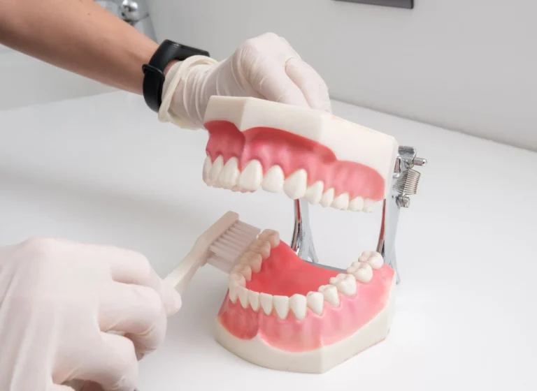 News 1 Cosa Sono le Faccette Dentali